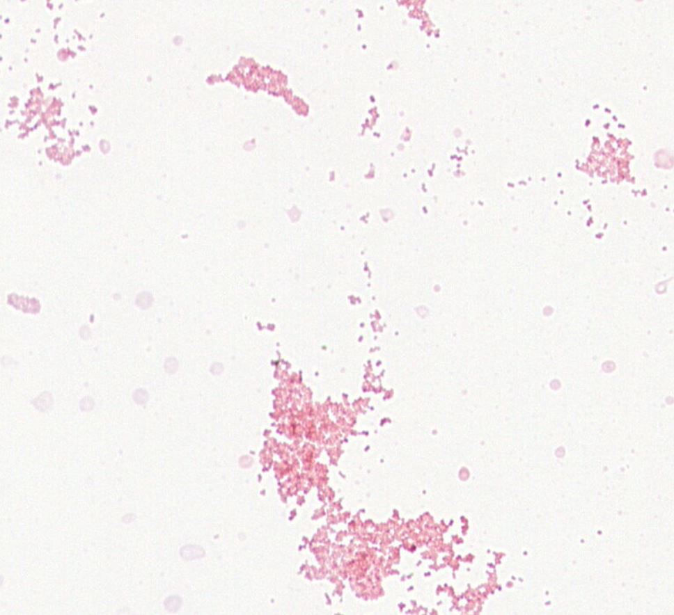 Vibrio neonatus GMB1471