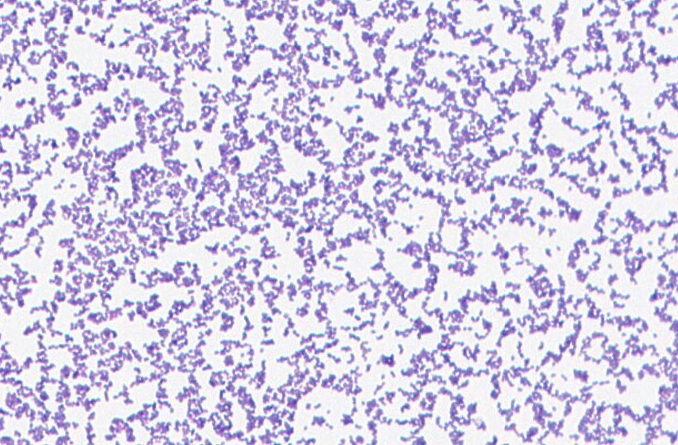 Leuconostoc citreum GMB1040