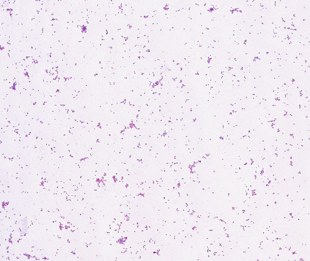 Streptococcus sp. GMB1937