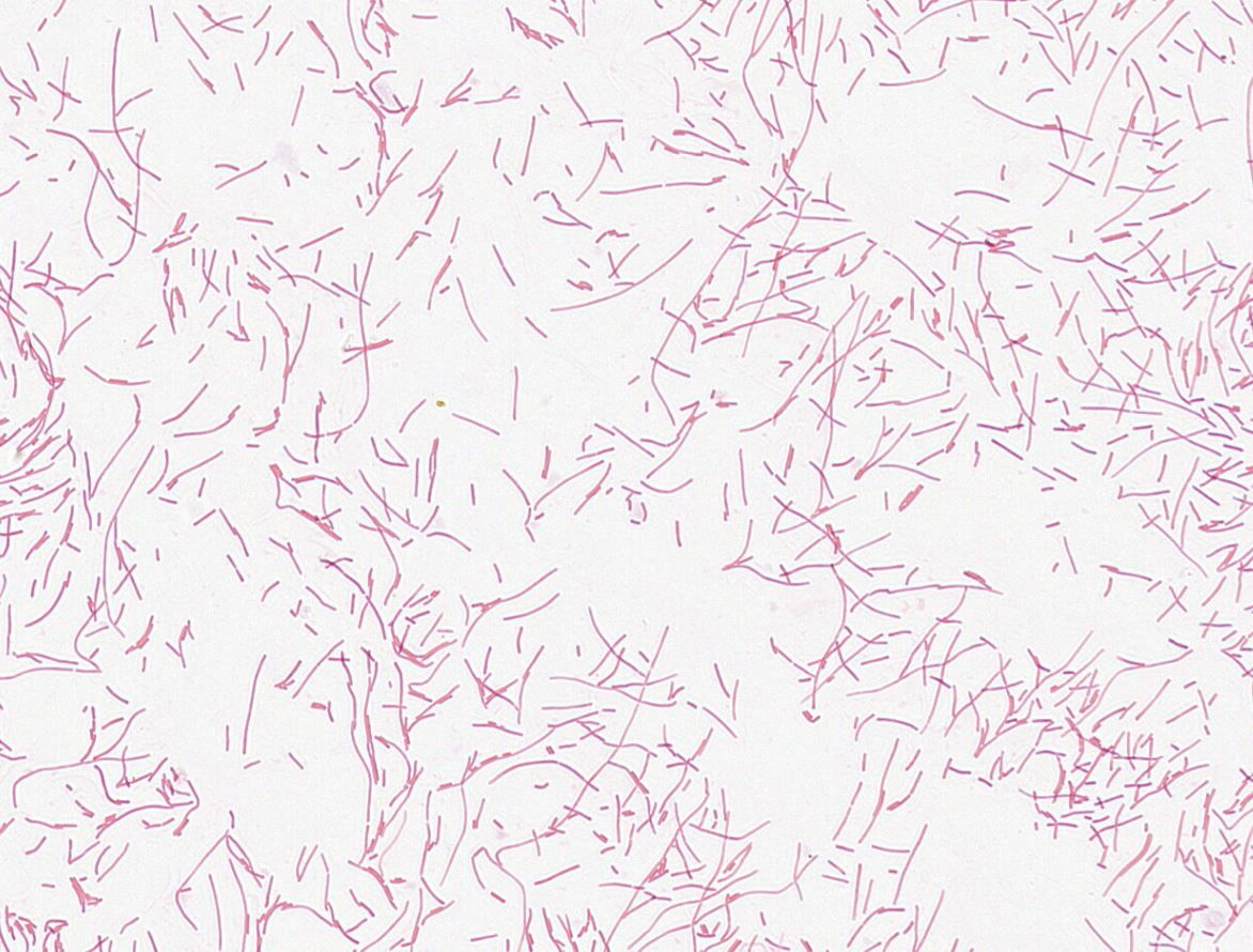 Lactobacillus crispatus GMB0079