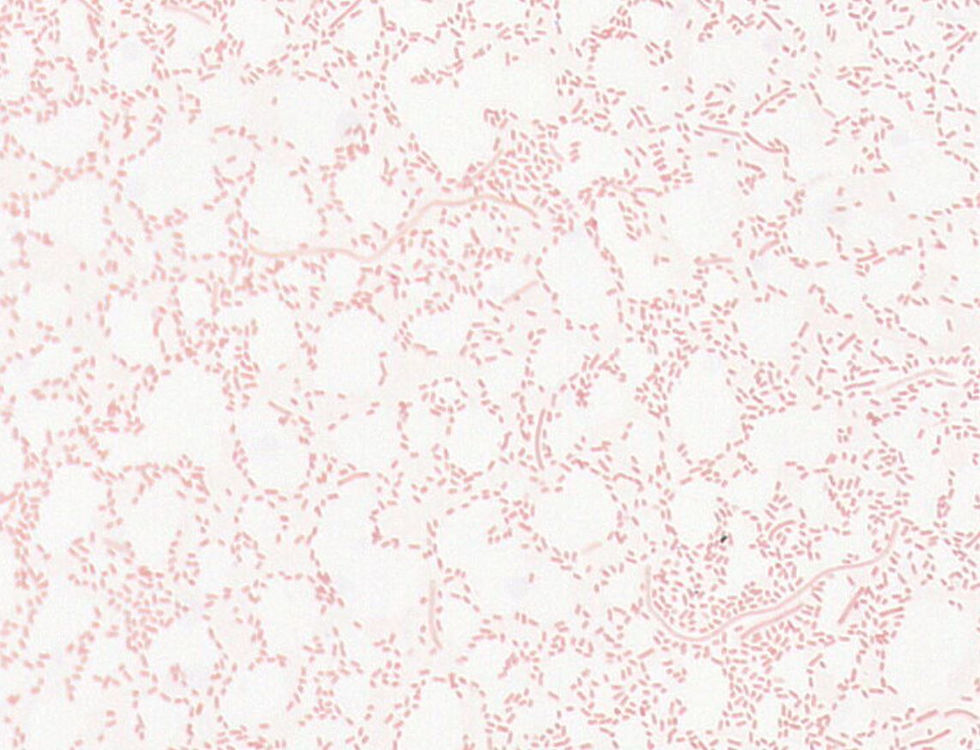 Escherichia coli GMB2336