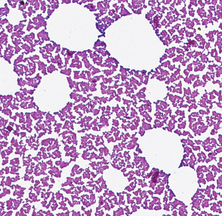 Staphylococcus GMB2051