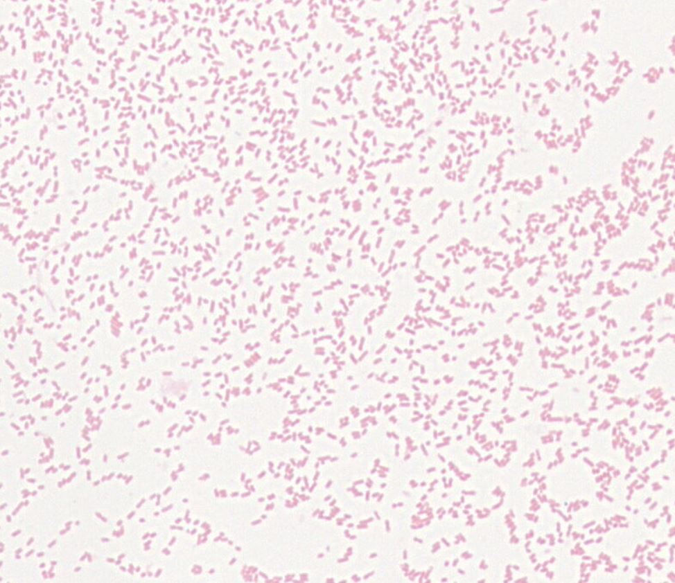 Edwardsiella sp. GMB1830