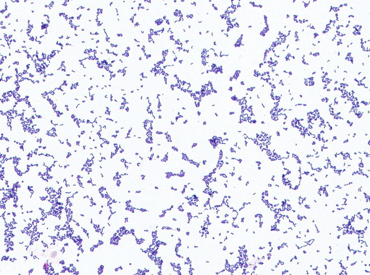 Bifidobacterium sp. GMB0712