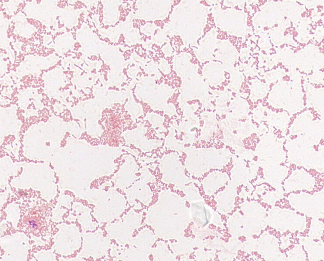 Parabacteroides merdae GMB0357