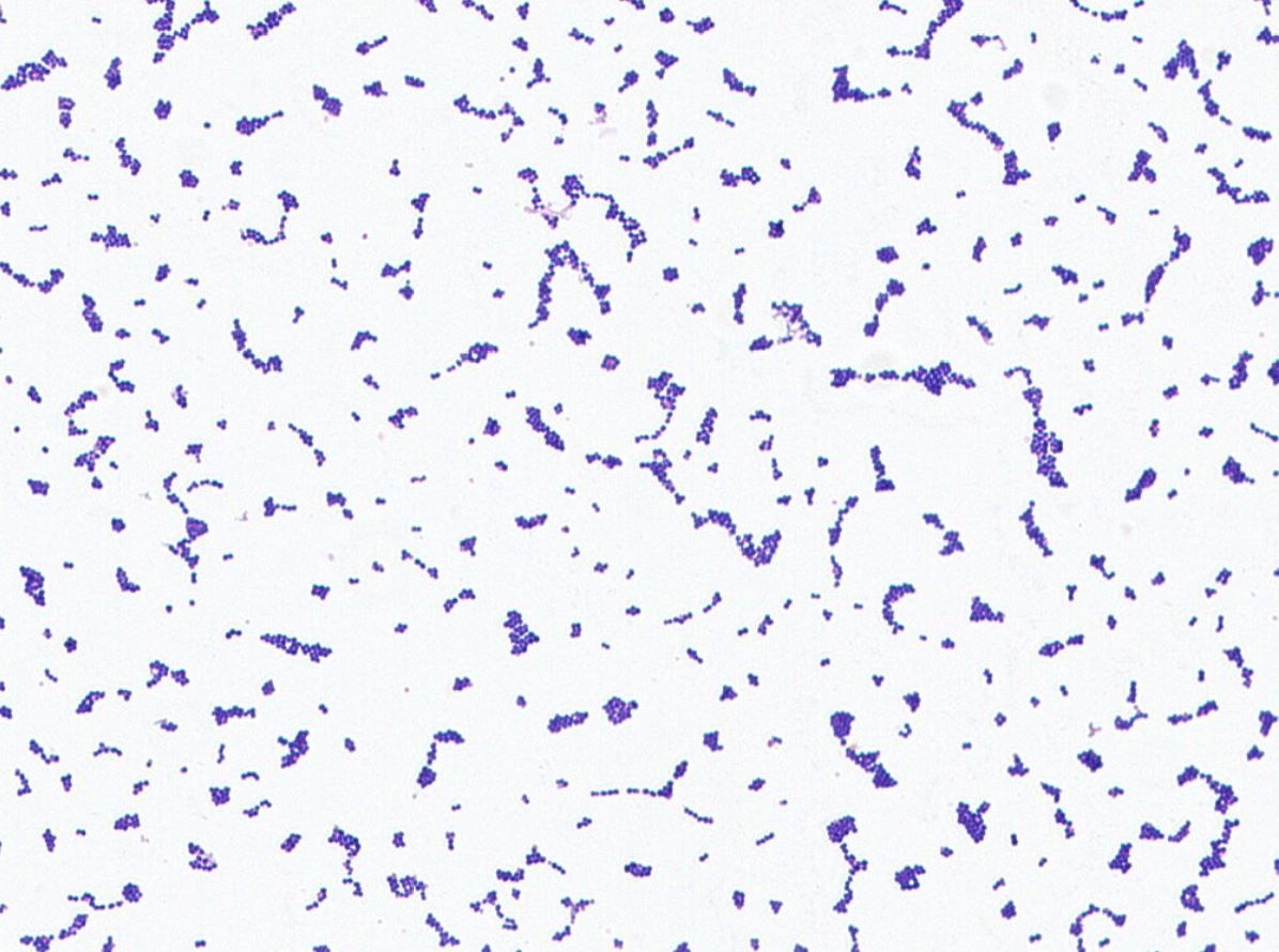 Enterococcus hulanensis GMB0077