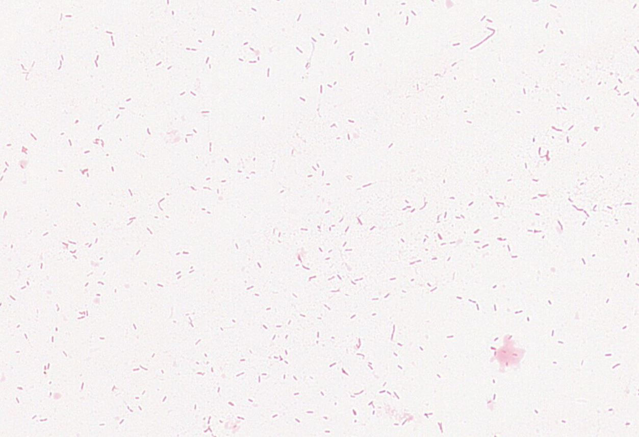 Clostridium sp. GMB2125