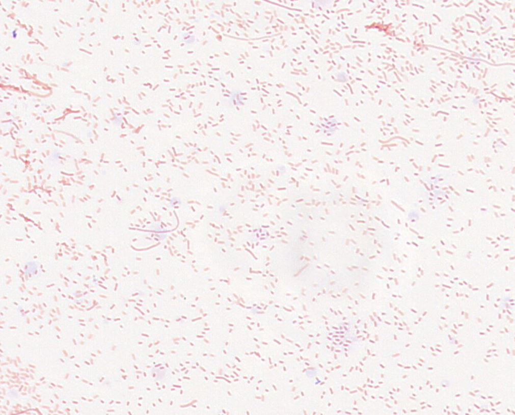 Bacteroides oleiciplenus GMB0383