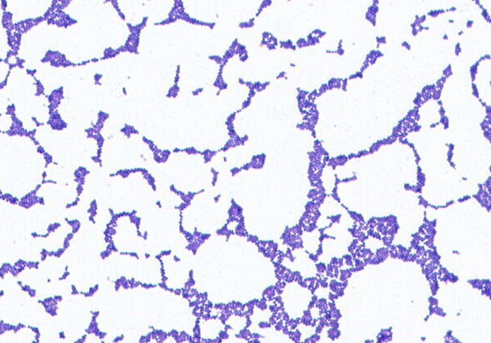 Staphylococcus epidermidis GMB1452