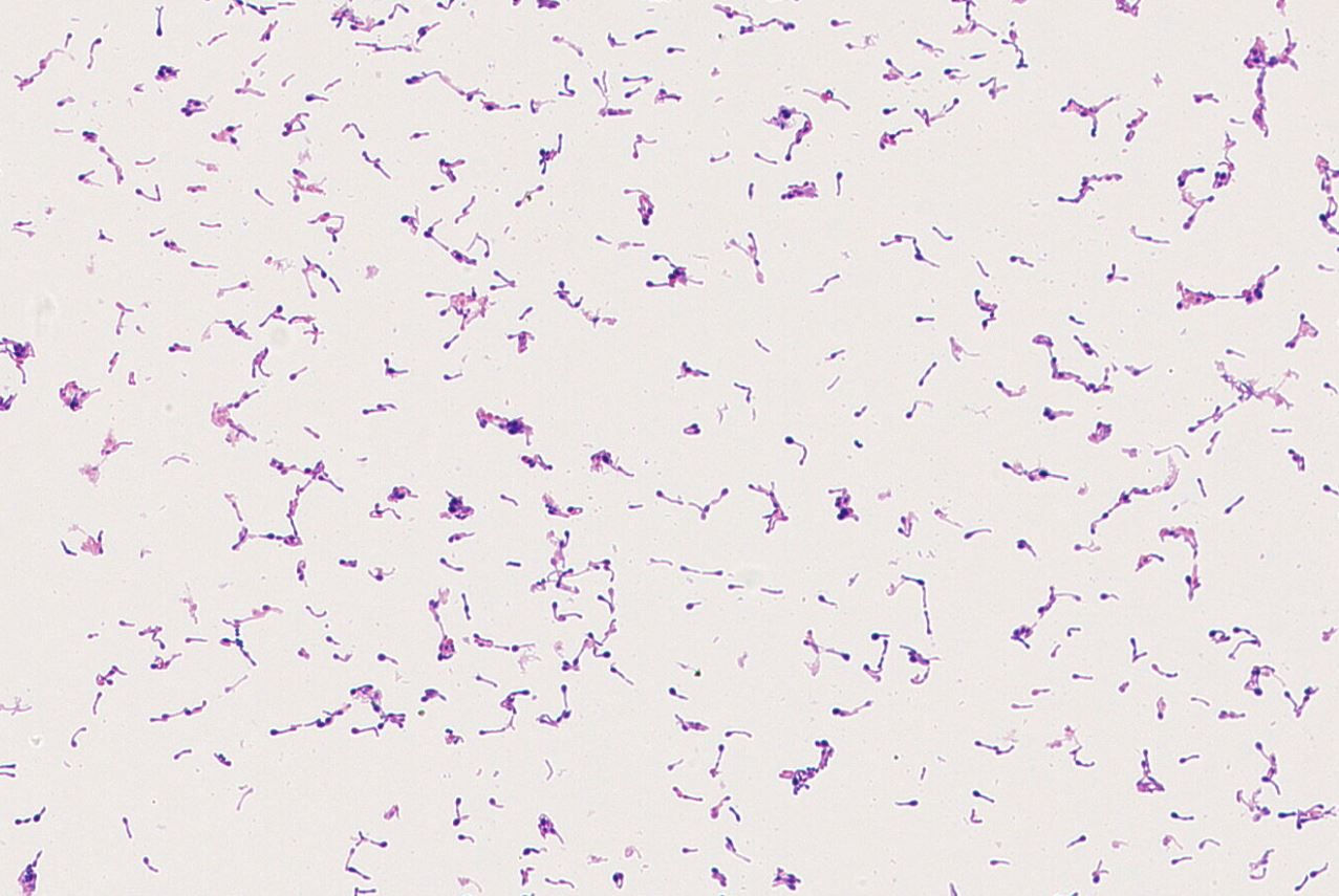 Clostridium  sp GMB1117