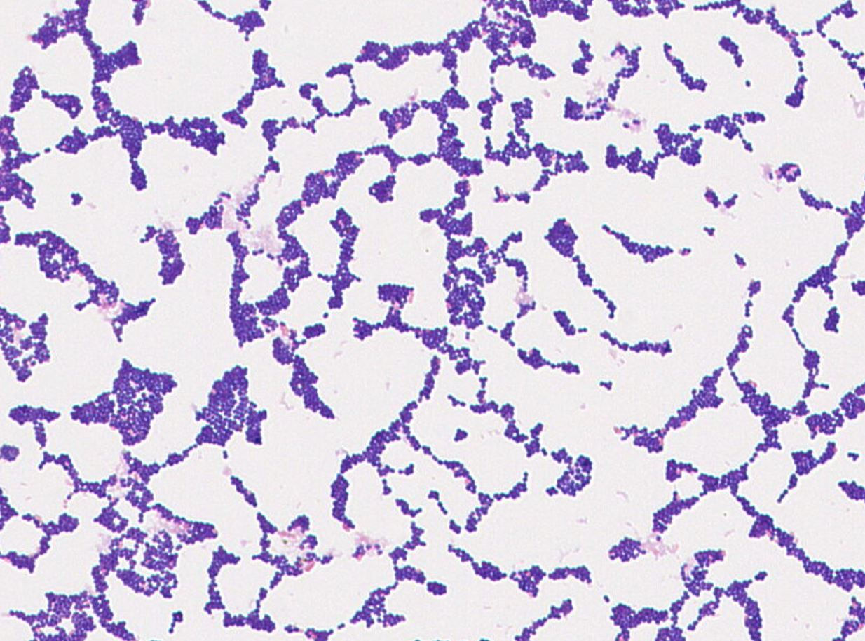 Clostridium sp. GMB0683