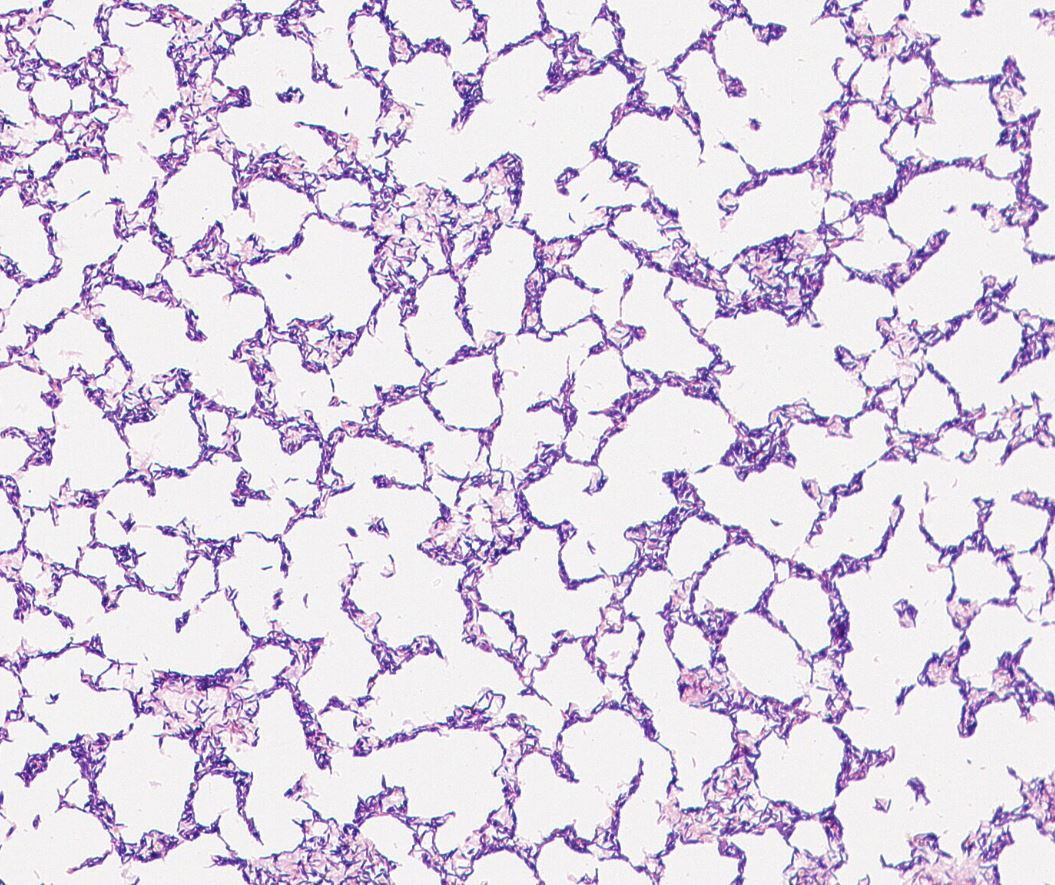 Bifidobacterium longum GMB1603