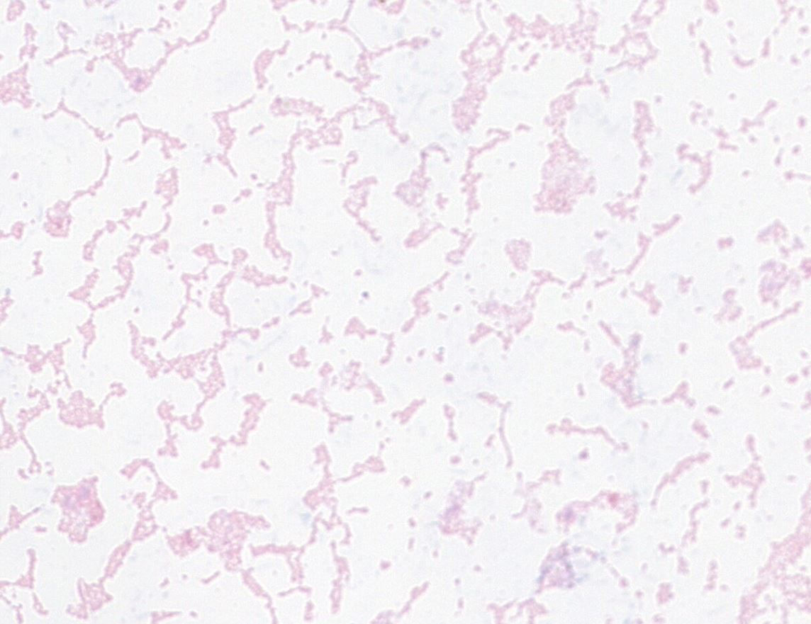 Streptococcus vaginalis GMB2362