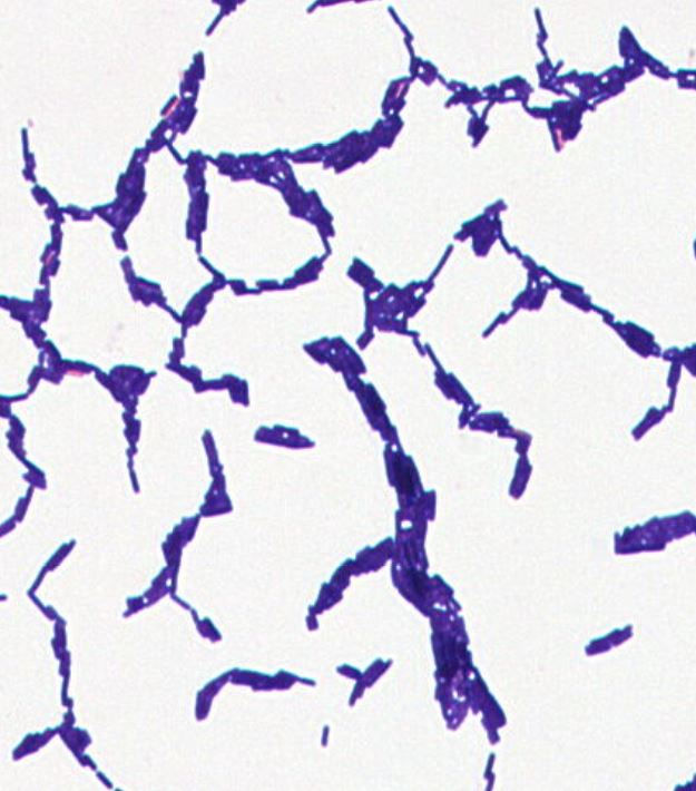 Bacillus sp. GMB2145