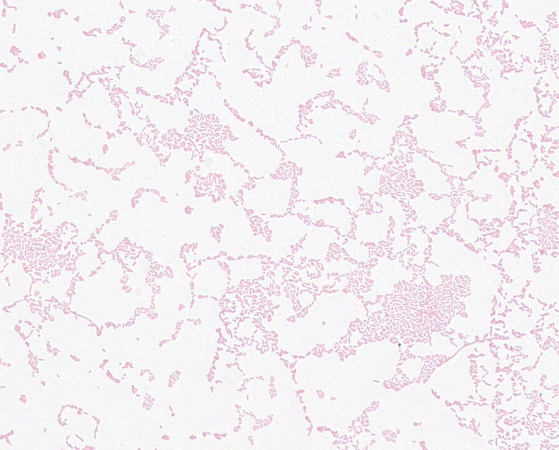 Proteus vulgaris GMB0980