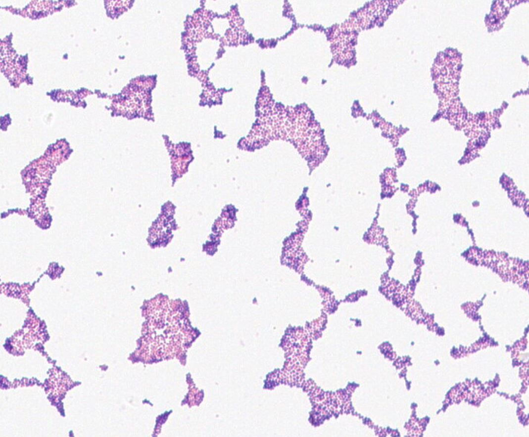 Enterococcus faecium GMB0989