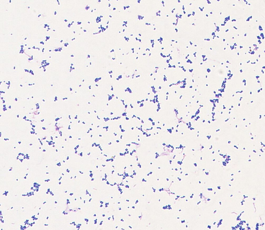 Streptococcus anginosus  GMB0774