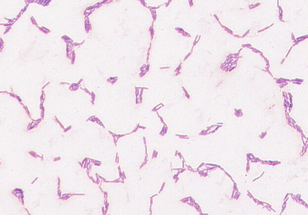 Quambalaria cyanescens  GMB0506