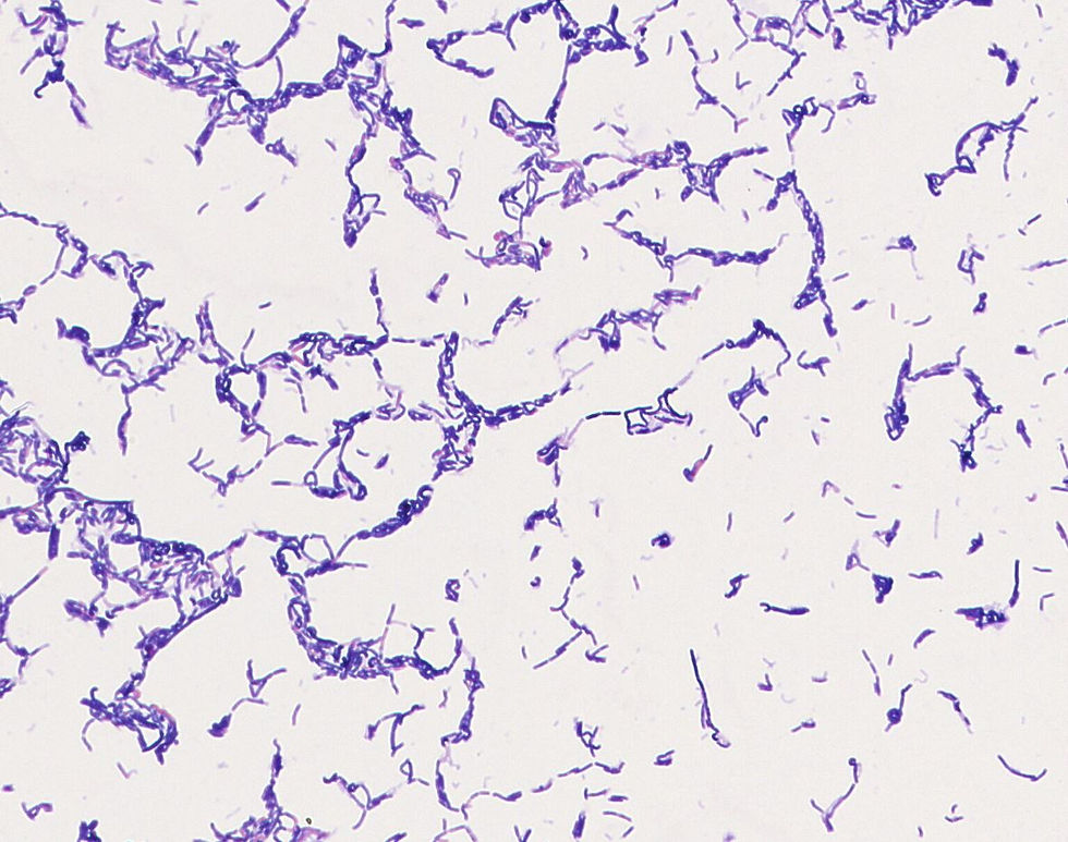 Lactobacillus jensenii GMB0086