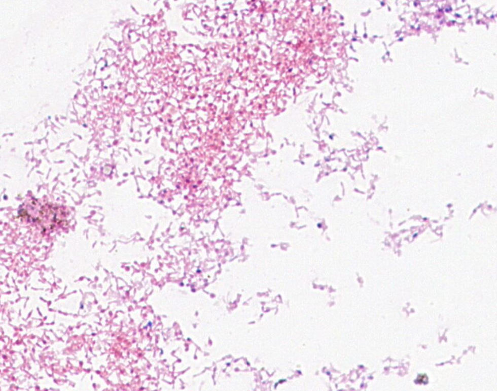 Bifidobacterium sp. GMB1959