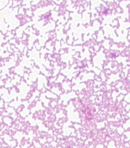 Morganella sp. GMB2326