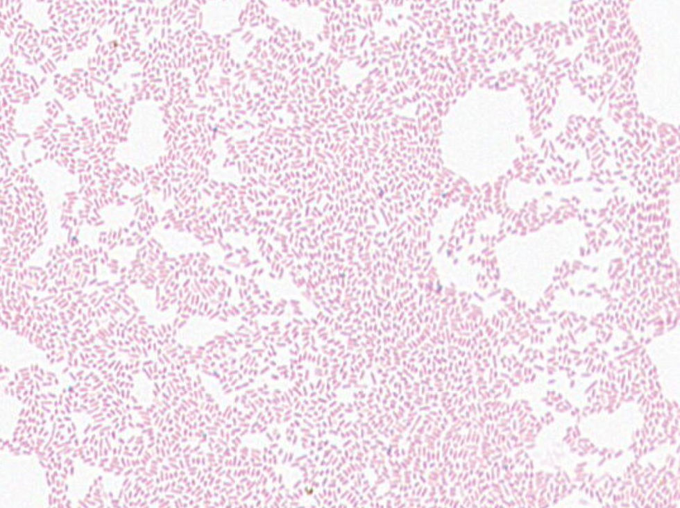 Escherichia sp. GMB2163