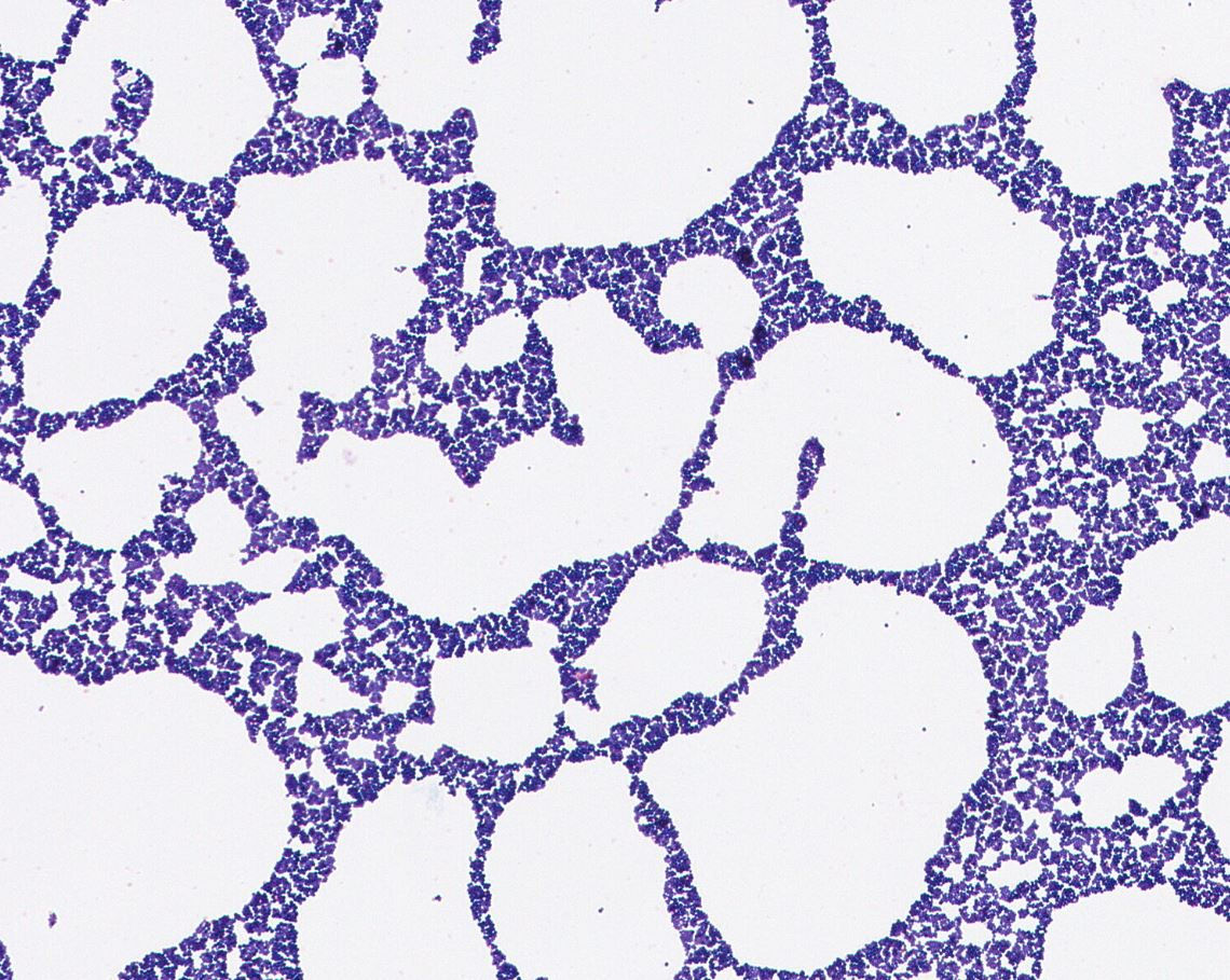 Staphylococcus arlettae GMB1706