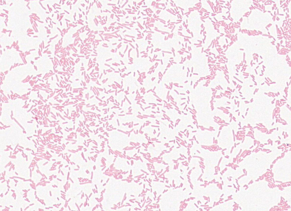 Escherichia sp. GMB1125