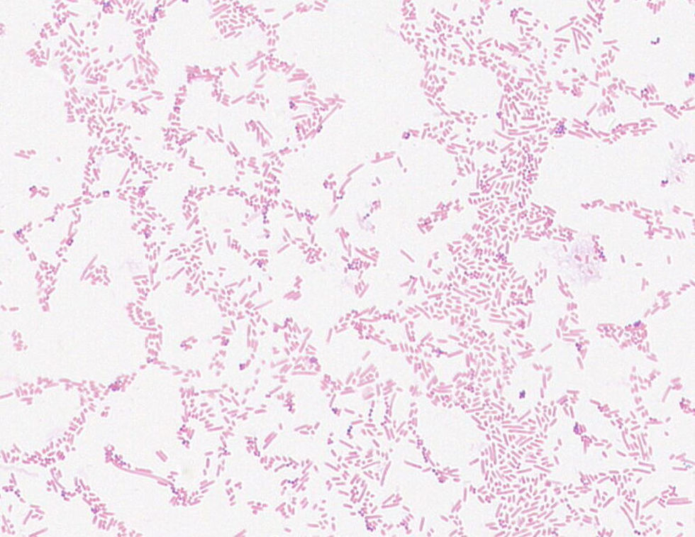 Klebsiella sp. GMB1952