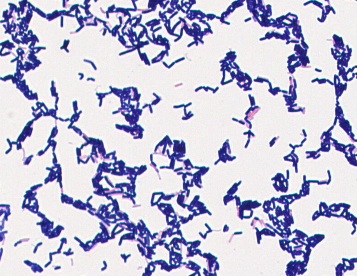 Bacillus sp. GMB1876