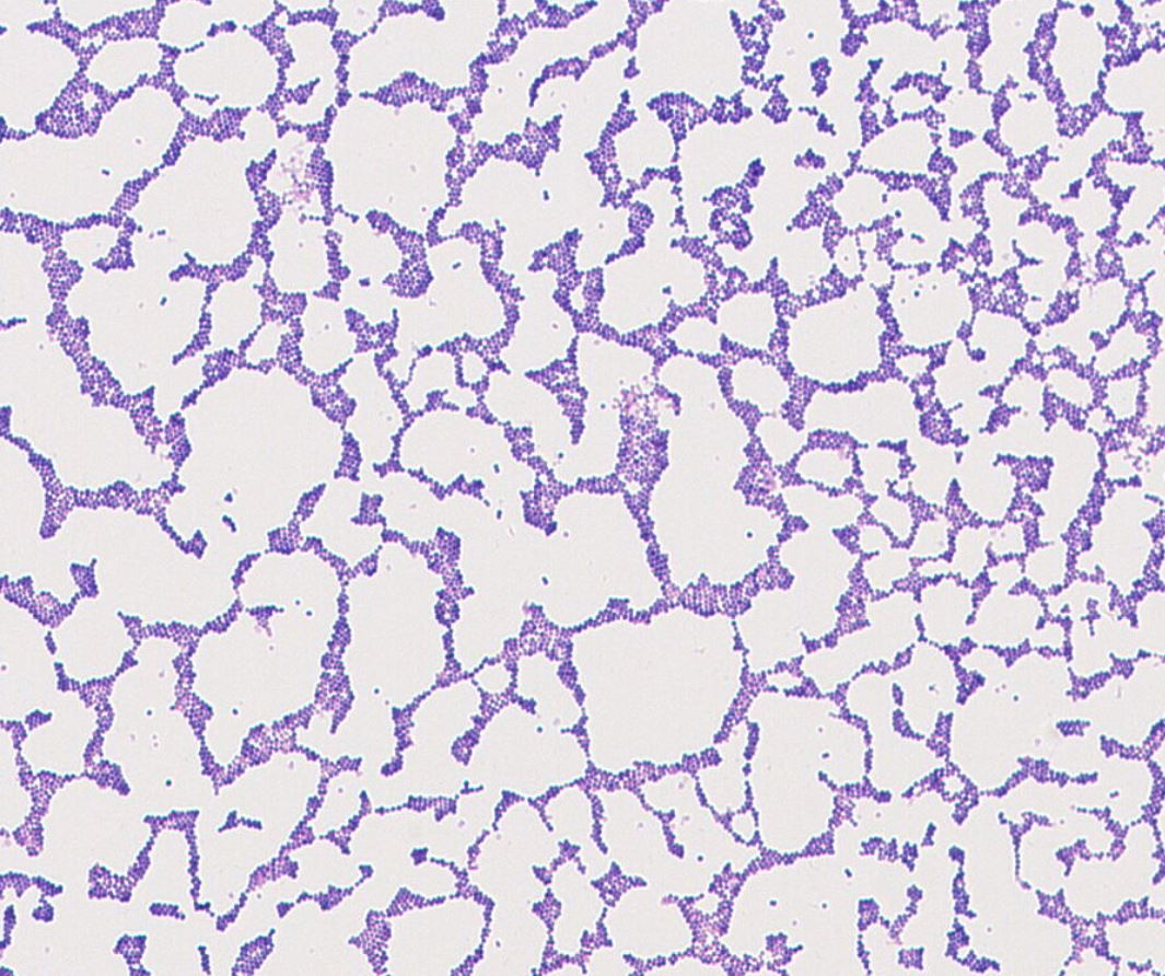 Staphylococcus haemolyticus GMB0852