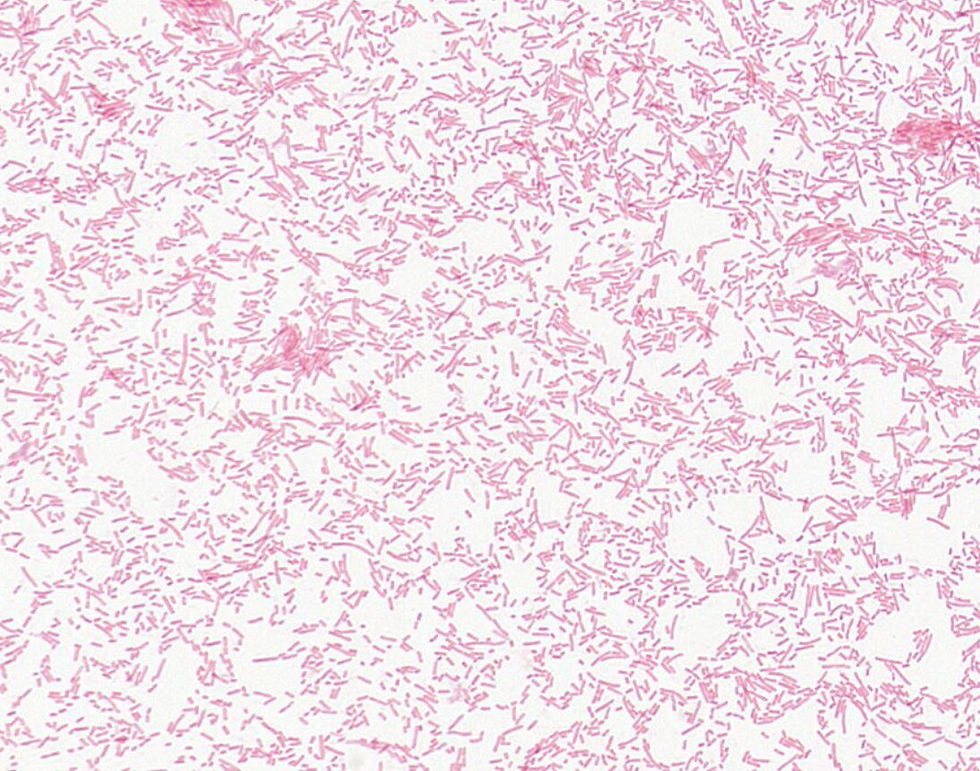 Escherichia sp. GMB2169