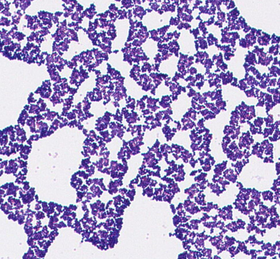 Staphylococcus sp. GMB1757