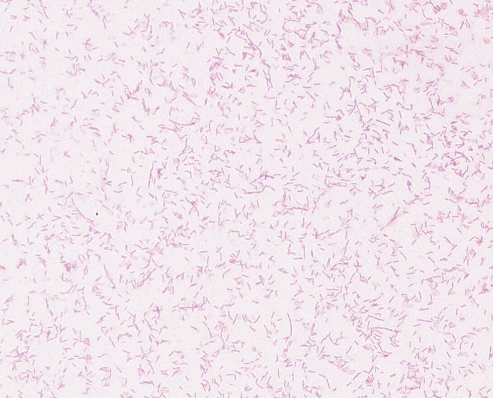 Lysinibacillus boronitolerans GMB1241