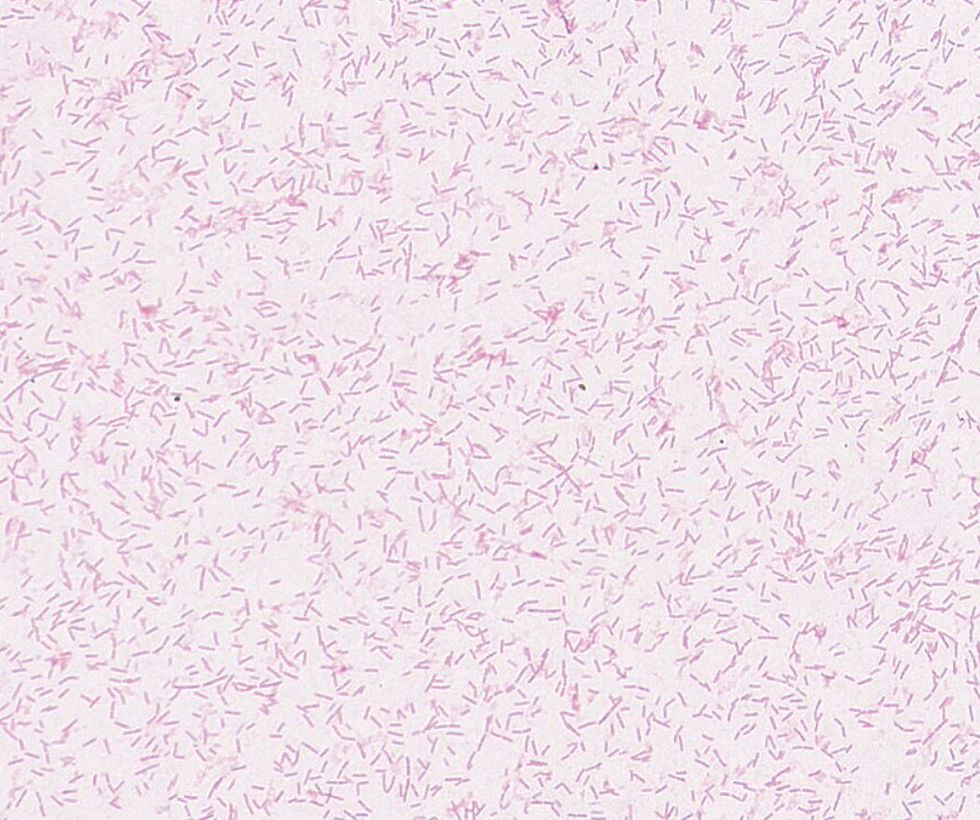 Campylobacter sputorum GMB0472