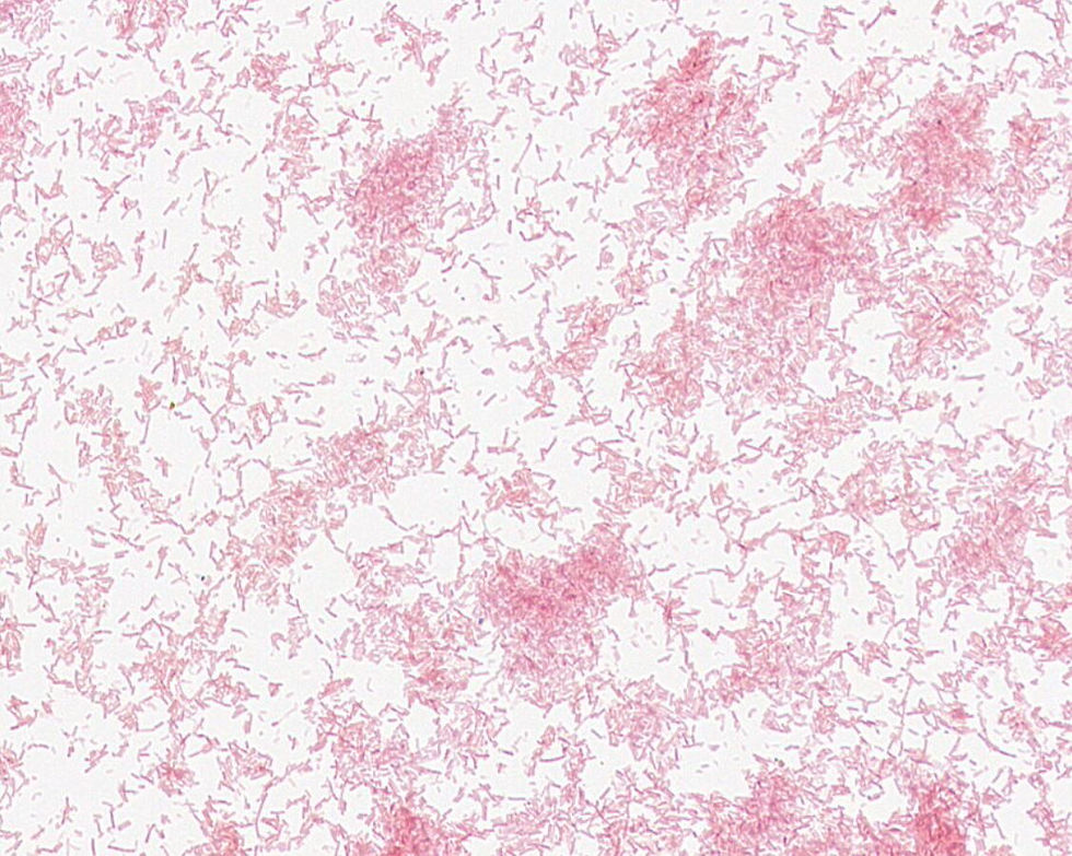 Clostridium aldenense GMB0293