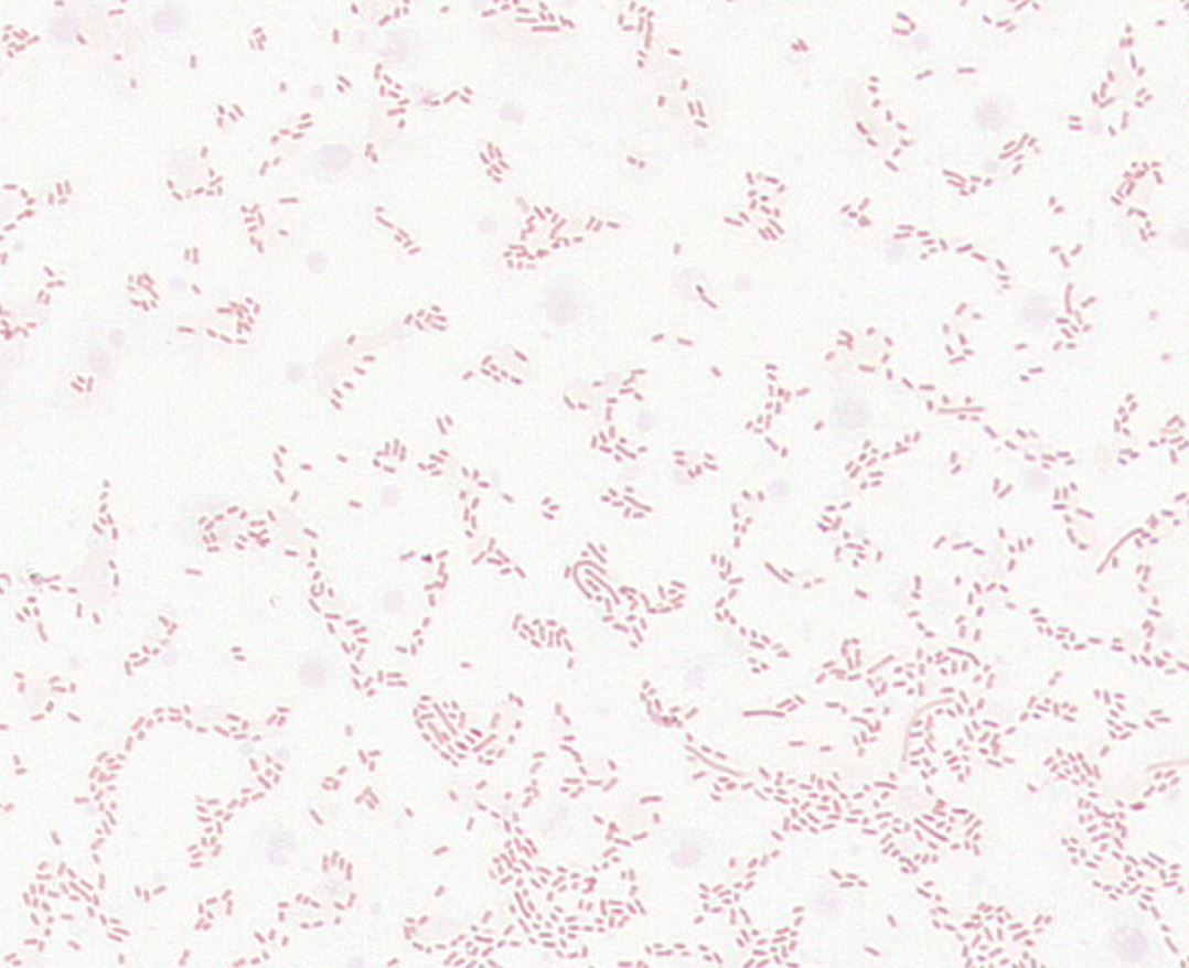 Pseudomonas sp. GMB2337