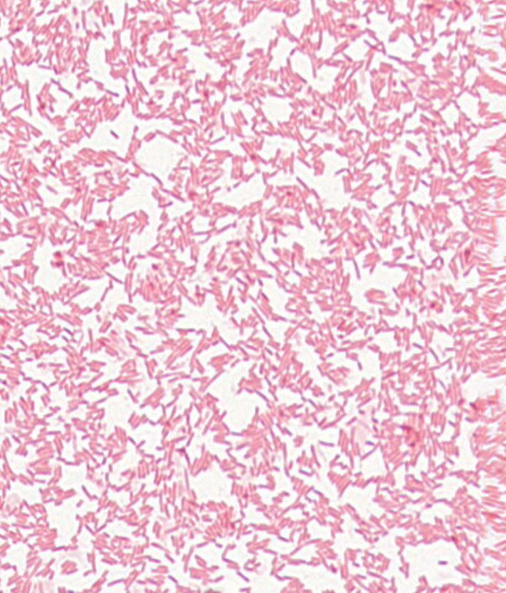 Escherichia sp. GMB2068