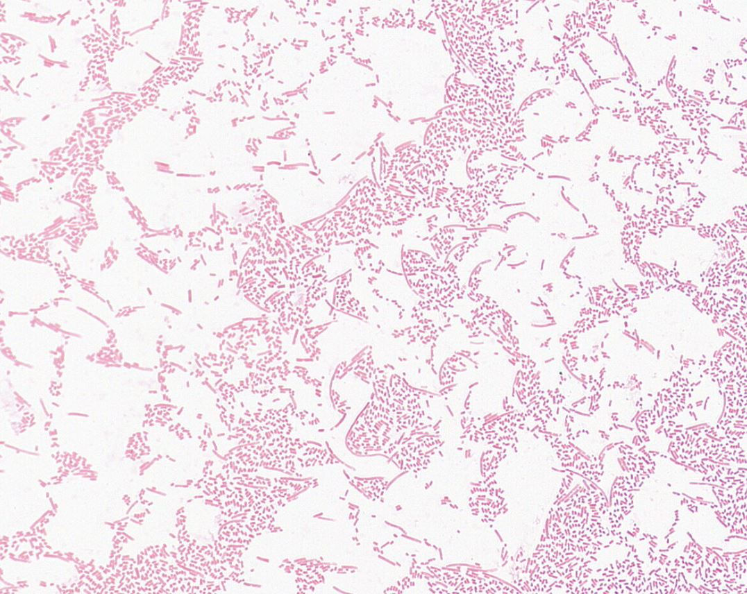 Citrobacter freundii GMB1668