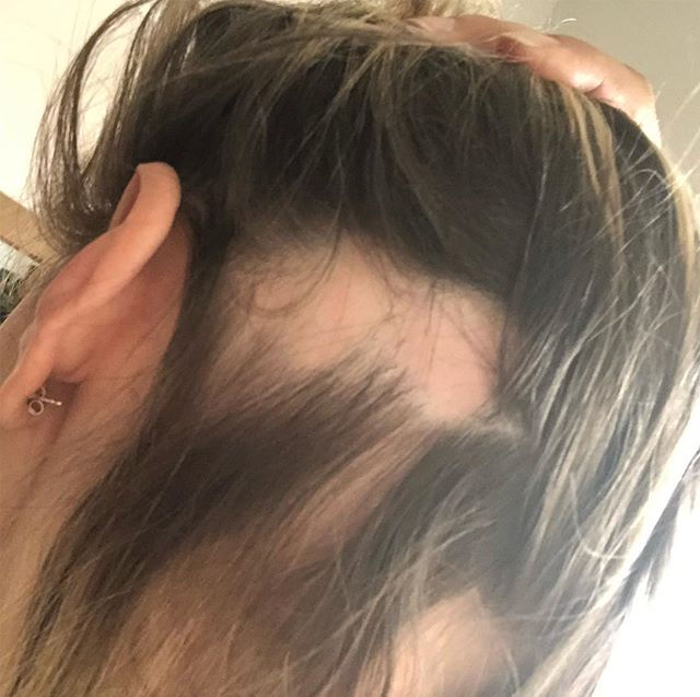 Still unsure of this is getting worse or