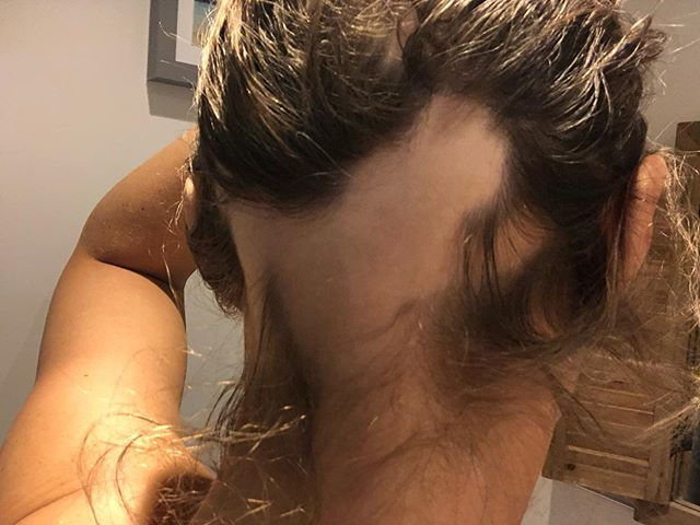 Think that back loss is creeping up agai