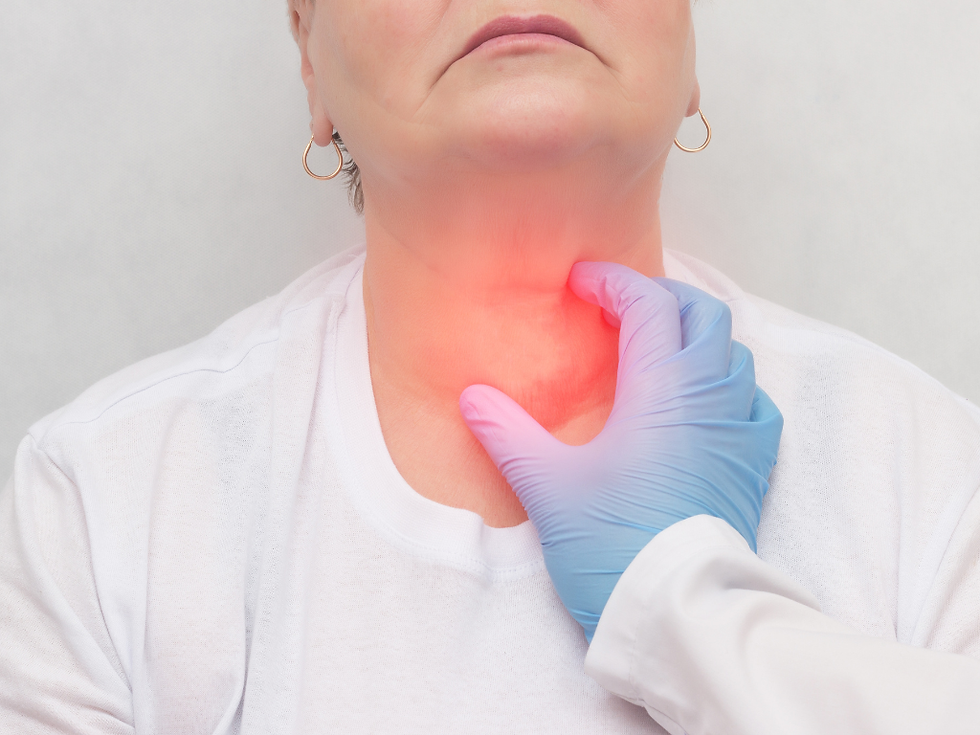 CÁNCER DE CABEZA Y CUELLO