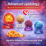 Lipid Clinic Toledo