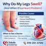 Leg Swelling Toledo Cardiology