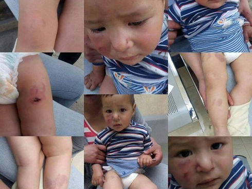 Agreden a bebe en una guardería en Pueblo Nuevo Durango