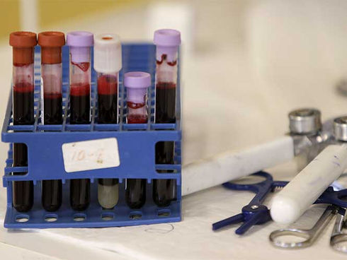 Miami pide ayuda federal para acabar con el zika