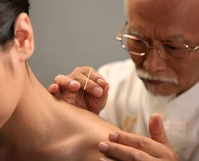 acupuntor.jpg