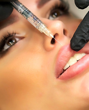 Lip filler dissolving treatment for clients near Arnold and Mapperley in Nottingham