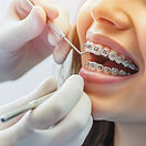 Retention und Notfallversorgung für langfristige Ergebnisse der Kieferorthopädie.