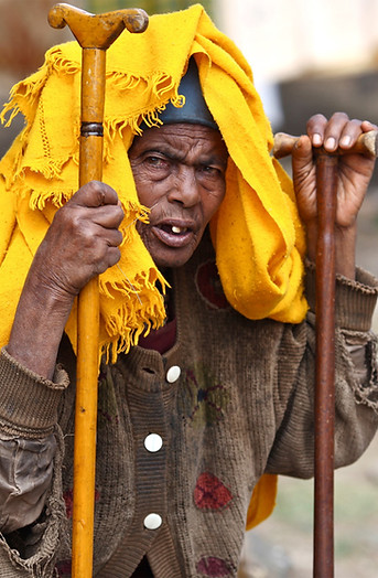 Impoverished homeless man